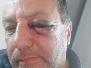 HPErcdIW0AAwqbX